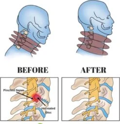 Anti Nekpijn Opblaasbaar Kussen | Nekkussen | Reiskussen | Verlicht Nek En Schouderpijn | Blauw - Neksteun | Nek Stretcher | Zacht Fleece | Cervicaal Nektractie Kussen | Nek Brace | Luxe | Ergonomisch | Opblaasbaar | Fluweel -Voyago Winkel 1166x1200 12